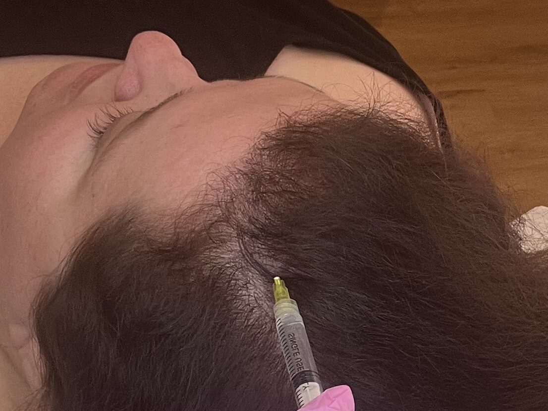 Say no to dandruff, scalp inflammation and hair loss.