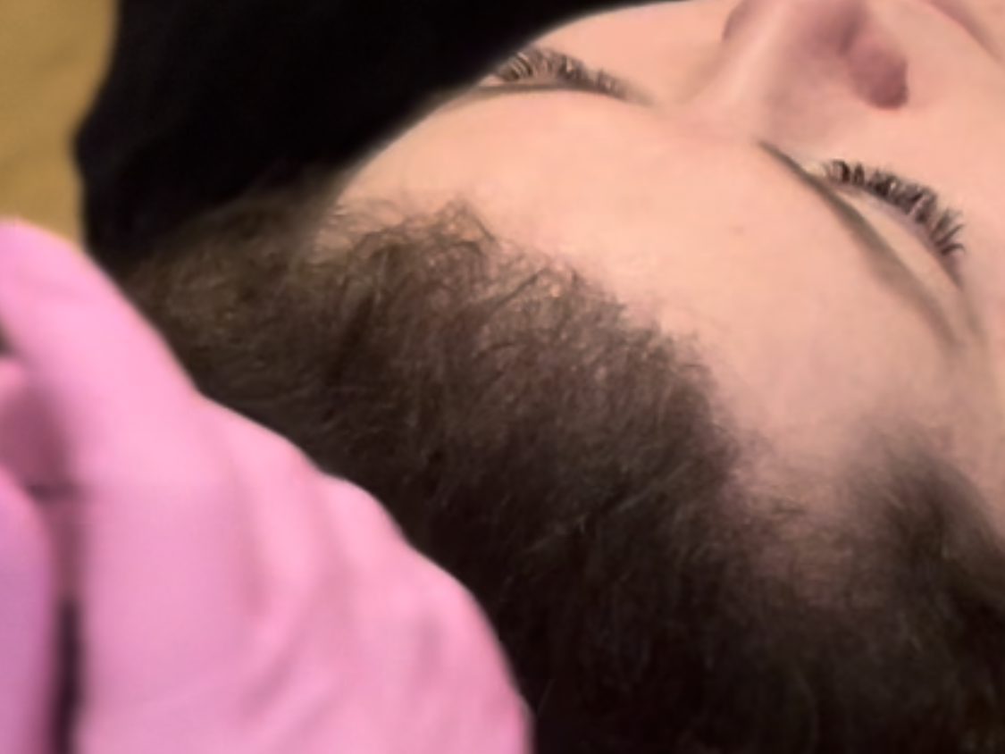 Hair and Scalp Rejuvenation
